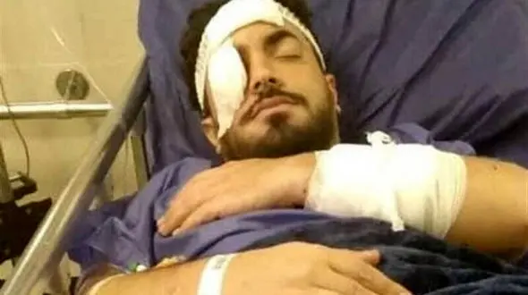 جزئیات ضرب و شتم وحشیانه یک روحانی در تهرانپارس + عکس 