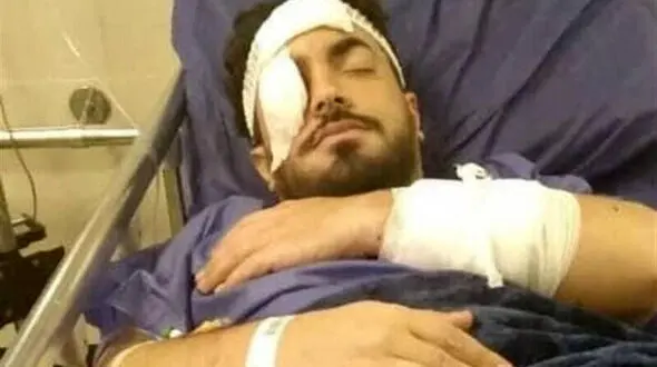 جزئیات ضرب و شتم وحشیانه یک روحانی در تهرانپارس + عکس 