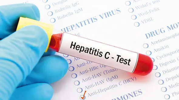 تعهد ایران برای حذف هپاتیت C تا ۱۴۰۵