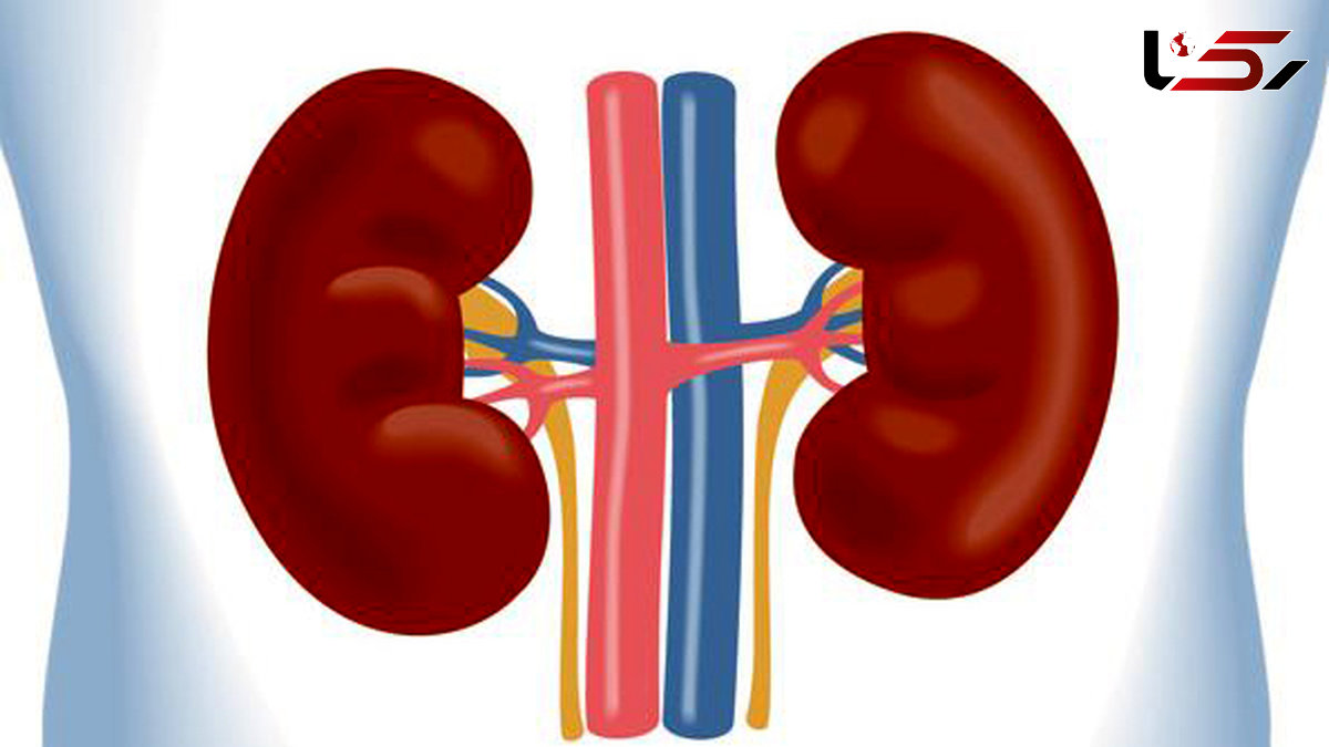 مراقب لوبیای سحر آمیز بدنتان باشید/  سنگ کلیه در مردان ایرانی شایع تر است