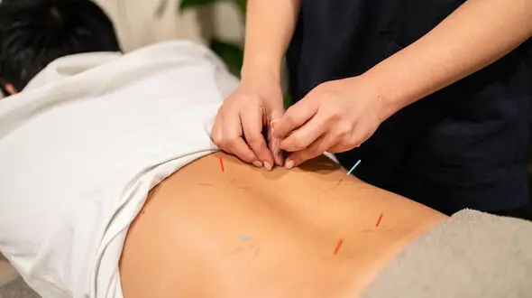 طب سوزنی برای سیاتیک؛ فواید، شواهد و عوارض احتمالی