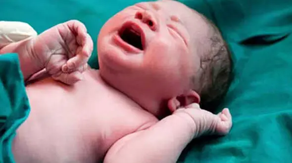 تولد یک نوزاد عجول در قم