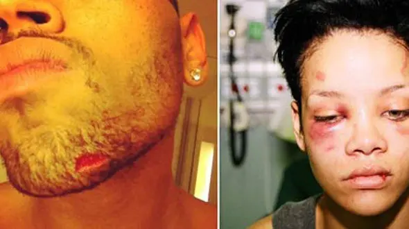 حمله وحشیانه به ریحانا + عکس