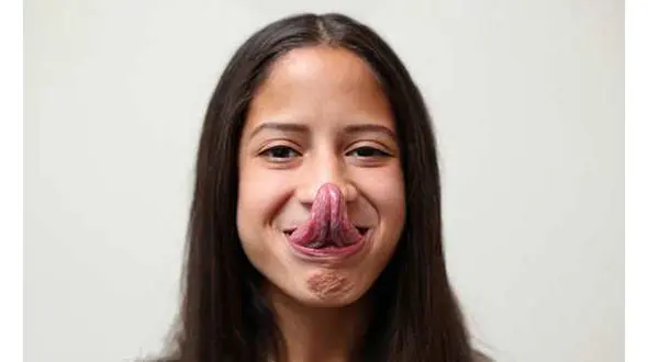 دختری با زبان 4 سانتی متری