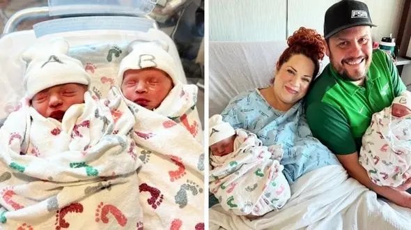 منحصربفردترین دوقلوی تاریخ به دنیا آمد! + تصاویر