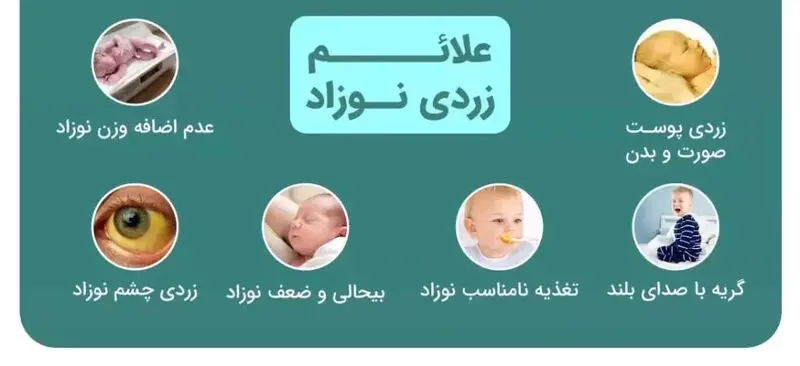 علائم یرقان در نوزاد