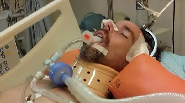 بلای وحشتناکی که میمون بازیگوش بر سر توریست 40 ساله آورد + عکس 