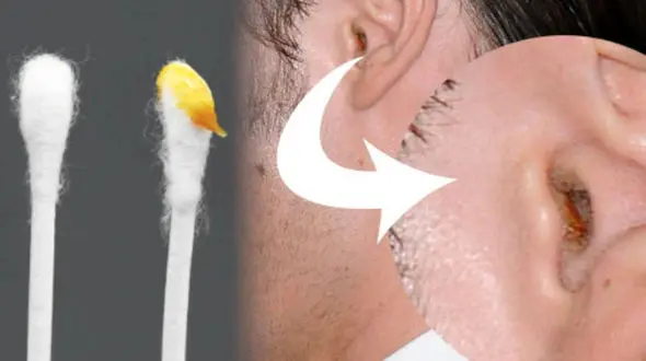 رازهای پنهان جرم گوش: نشانه‌ های سلامتی که نمی‌ دانستید