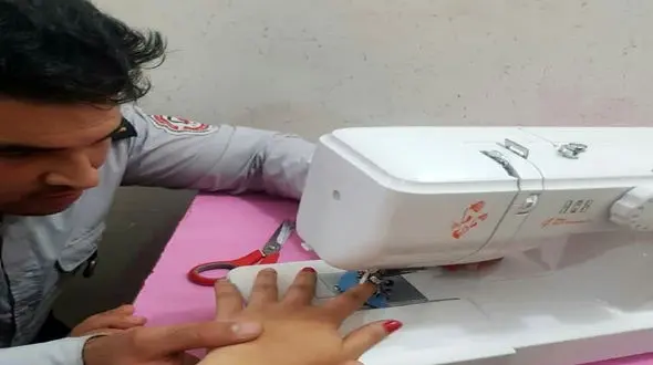 فرورفتن سوزن چرخ خیاطی در انگشت دختربچه قائمشهری