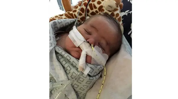 جنجال تصاویر لحظه به لحظه پدرو مادر از عمل پیوند نوزاد4ماهه شان+عکس