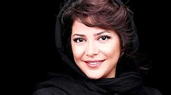 چهره غیر قابل تحمل طناز طباطبایی قبل از عمل زیبایی / طاقت ندارید نبینید ! + عکس