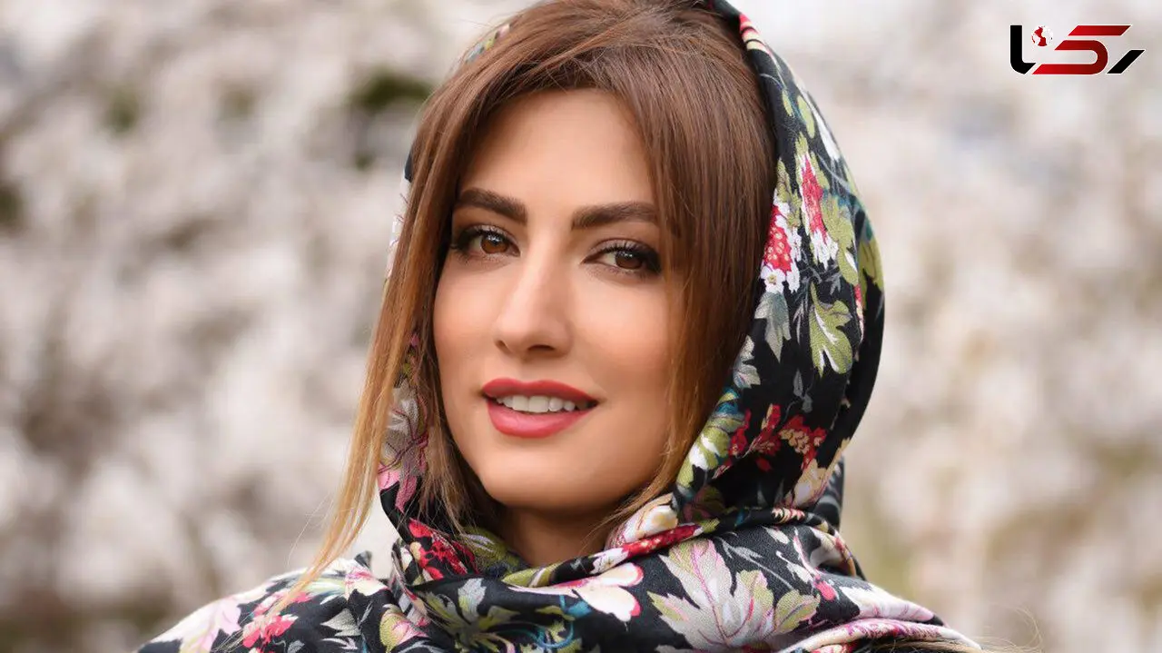 پروسه تغییرات چهره ای سمیرا حسینی / قبل و بعد از عمل زیبایی!