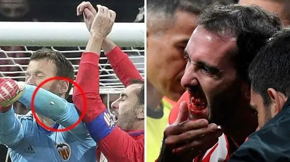  دندان مدافع روی بازوی دروازه بان جاماند! + تصاویر 