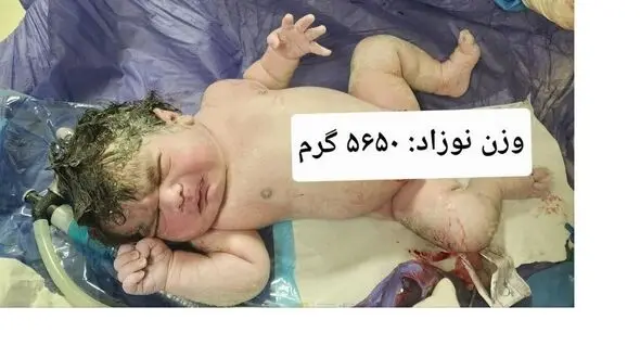 تولد نوزاد ۵.۶ کیلویی در کرمانشاه؛ کوچولویی به وزن یک نوزاد چندماهه! + عکس