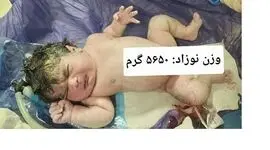 تولد نوزاد ۵.۶ کیلویی در کرمانشاه؛ کوچولویی به وزن یک نوزاد چندماهه! + عکس