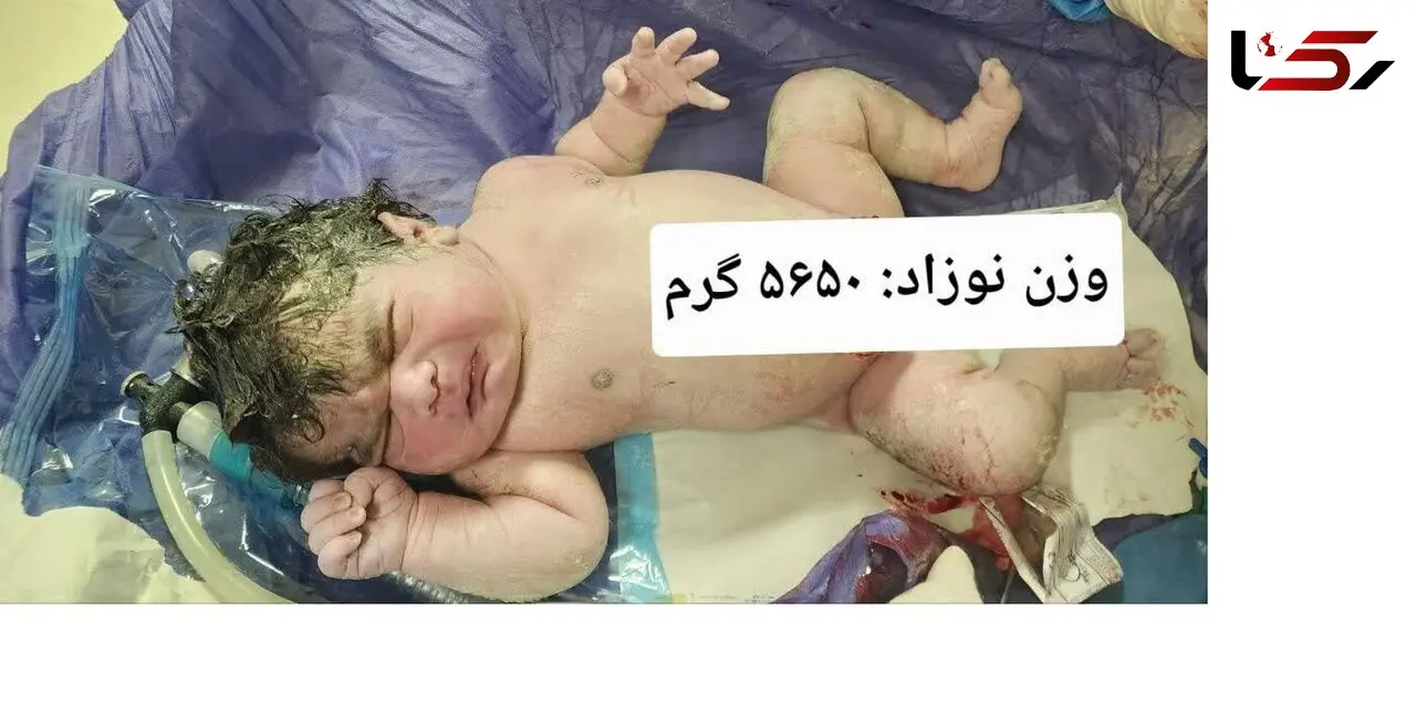 تولد نوزاد ۵.۶ کیلویی در کرمانشاه؛ کوچولویی به وزن یک نوزاد چندماهه! + عکس