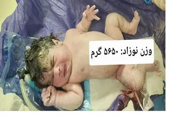 تولد نوزاد ۵.۶ کیلویی در کرمانشاه؛ کوچولویی به وزن یک نوزاد چندماهه! + عکس
