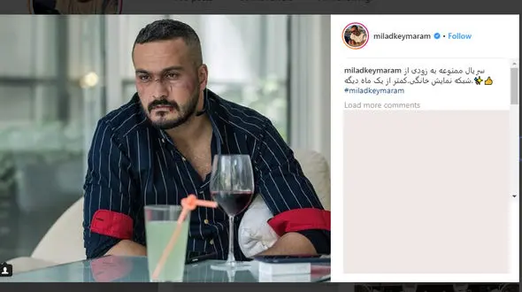 عکس بازیگر معروف با صورت کتک خورده و کبود!