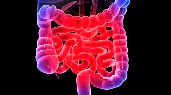 نشانه های خطرناک سرطان روده