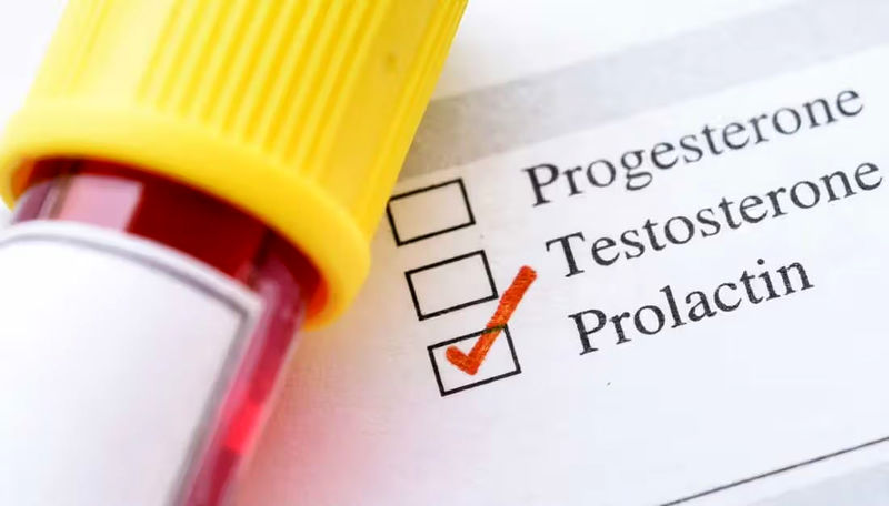 تست Prolactin