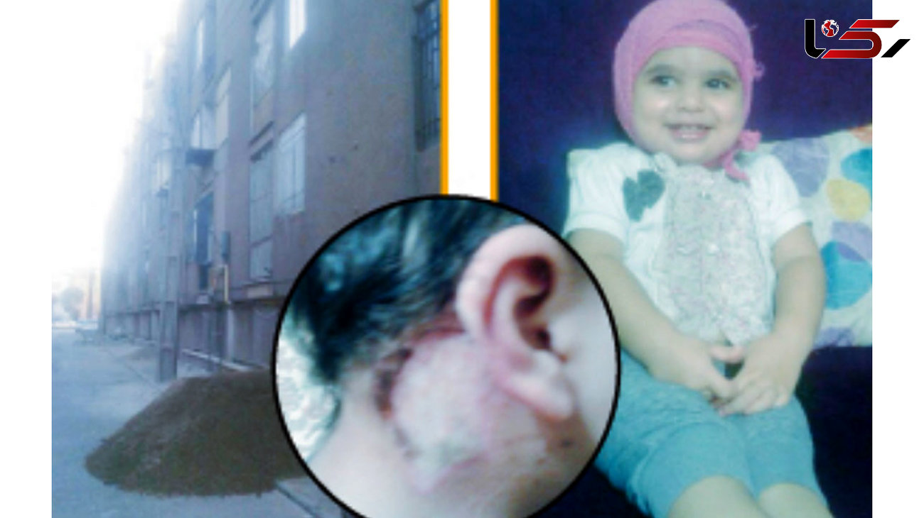 ناکامی پلیس تهران برای شناسایی عامل سوختگی عسل کوچولوی 2 ساله + عکس