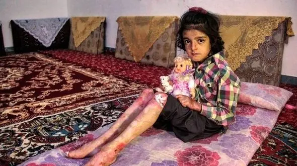 روایتی دردناک از پروانه‌هایی که در آتش تحریم می‌سوزند +تصاویر