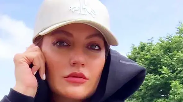 این عکس راز زیبایی مهناز افشار را لو داد / پول داشته باشی زیبا می شوی !  