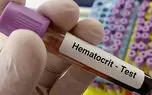 hematocrit چیست؟ / نحوه انجام آزمایش هماتوکریت + جدول