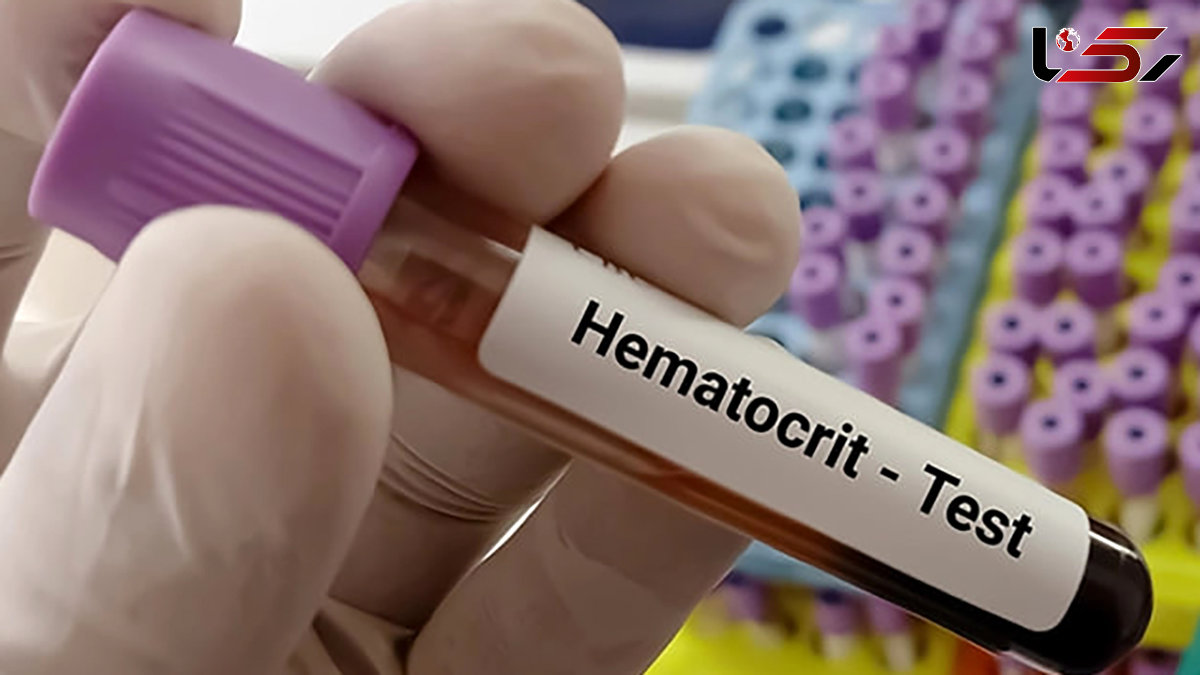 hematocrit چیست؟ / نحوه انجام آزمایش هماتوکریت + جدول