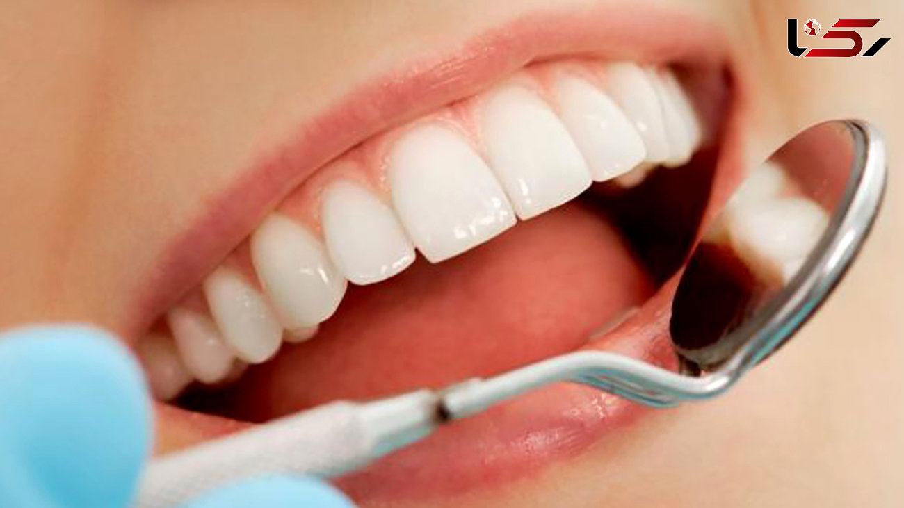 سندرومی که با رعایت نکردن بهداشت دهان سراغتان می آید 