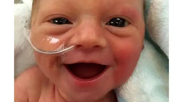 لبخند نوزاد نارس سوژه رسانه ها شد+عکس 