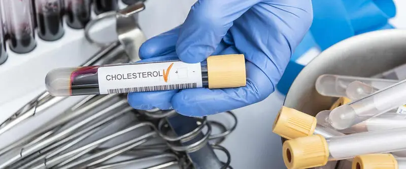 total cholesterol