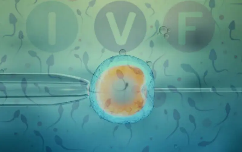 آی وی اف Ivf چیست؟ 