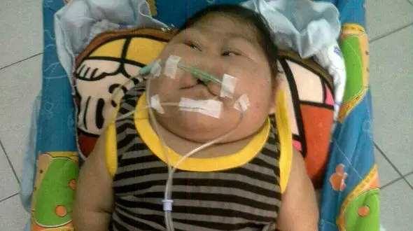 جدال با مرگ کودک 20 ماهه تایلندی+ عکس