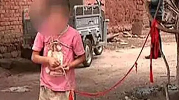 عکس/ رفتار وحشیانه با یک دختر / این دختر 5 ساله است که با زنجیر به یک درخت بسته شده است 