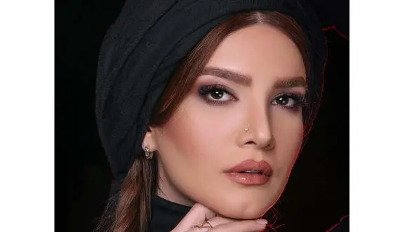 چهره لورفته متین ستوده قبل عمل زیبایی + عکس قبل و بعد خانم بازیگر که شوکه می شوید!