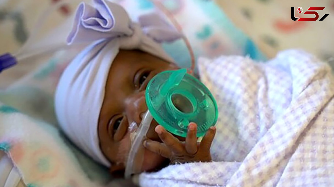 ترخیص کوچک‌ترین نوزاد متولد شده از بیمارستان