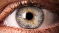 بهترین روش های درمان خشکی چشم