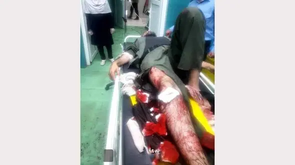 دیدن این عکس دل می خواهد / بلای شومی که بر سر محیط بان آمد / گتوند