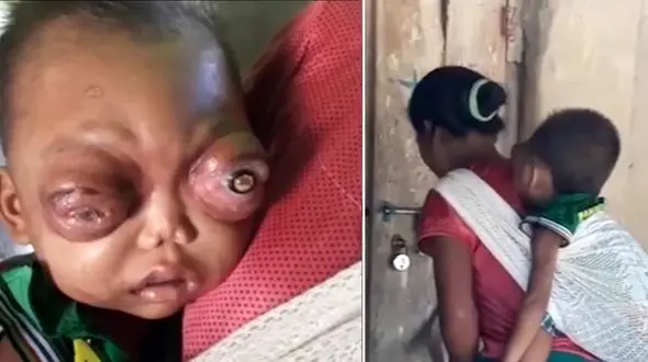 چشم های وحشتناک کودک 2 ساله همه را شوکه کرد + فیلم و عکس