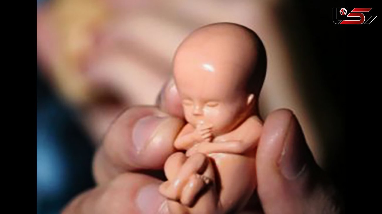  فاجعه سقط جنین در ایران  / سالانه 300 هزار سقط جنین غیرقانونی در کشور انجام می شود