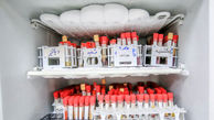 اهدای ۱۶۱ دستگاه کمک تنفسی به بیمارستان های مازندران
