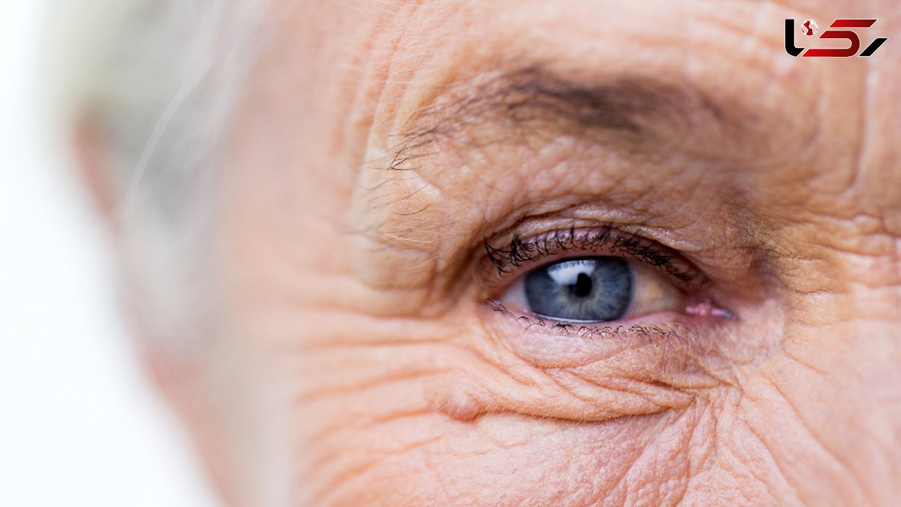 سلامت چشم با ساده ترین روش های بهداشتی