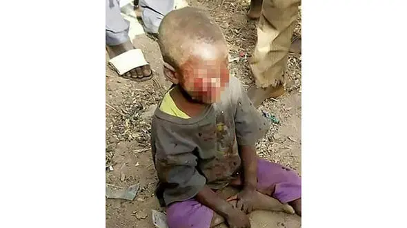 تنبیه وحشیانه کودک به خاطر شب‌ادراری +عکس 