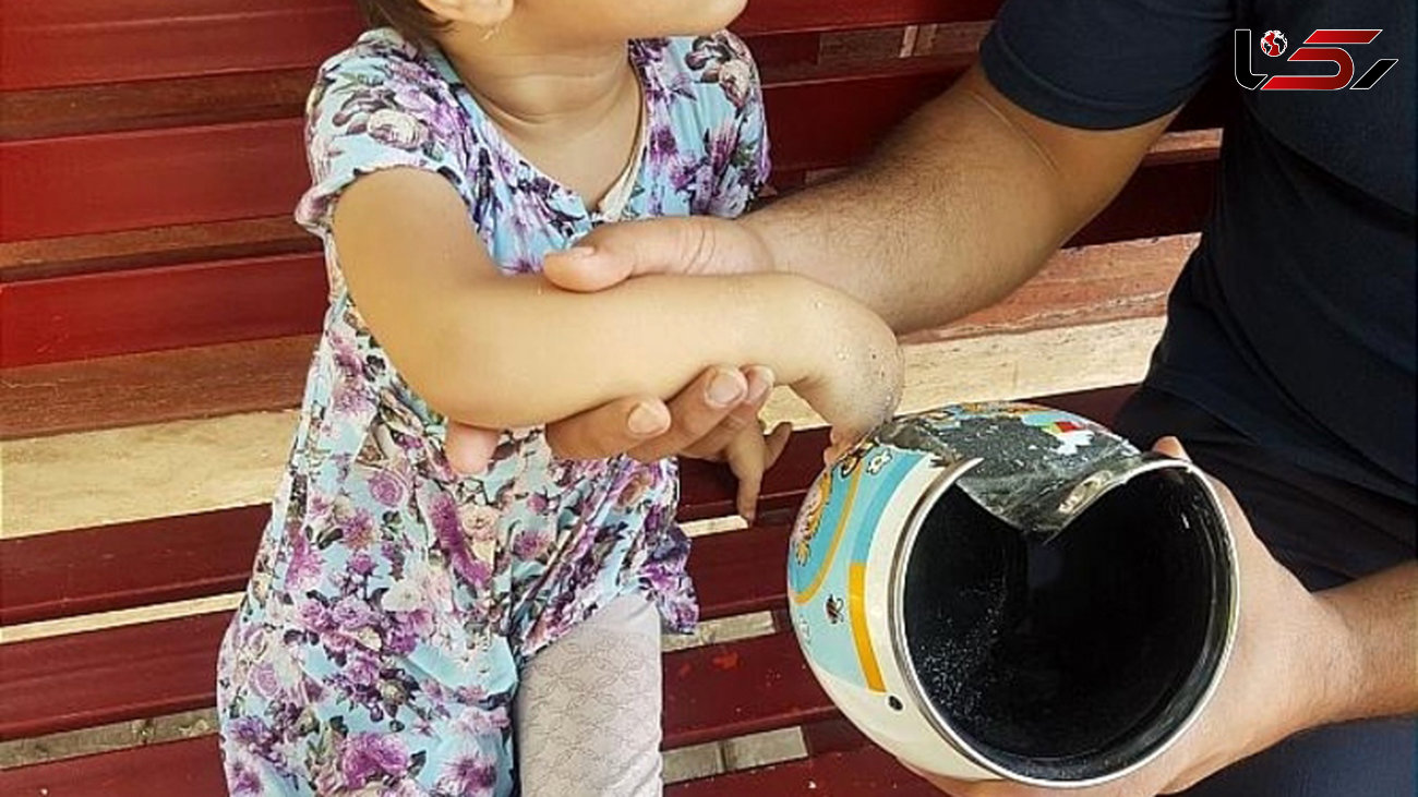 نجات انگشت کودک از لوله کتری در تهران + عکس 