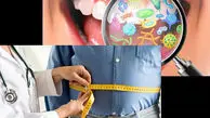 میکروب‌های دهان می‌توانند کلید پیشگیری از چاقی باشند