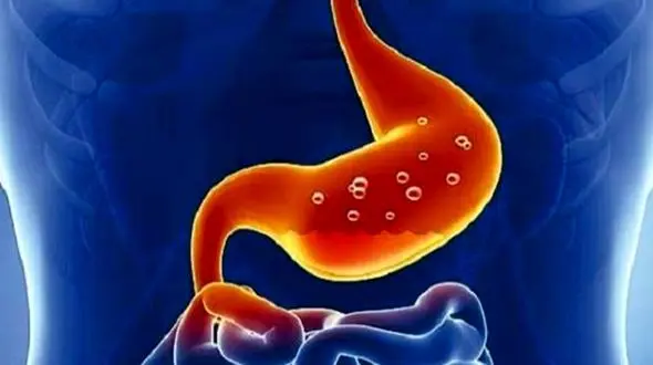 چه عواملی باعث ایجاد سرطان معده  می شود؟