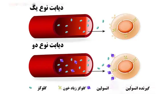دیابت نوع یک و 2 چه فرقی دارند؟ / فیلم