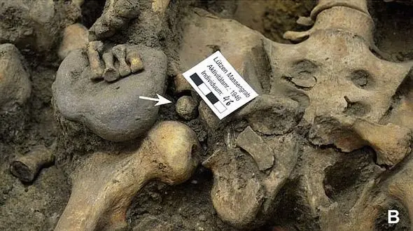 عکسی مخوف از اسکلت های انسانی در گور دسته جمعی + تصاویرعجیب