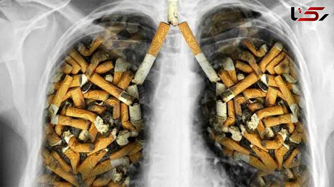 سیگار، الکل و اضافه وزن، عامل نیمی از مرگ و میرهای ناشی از سرطان 